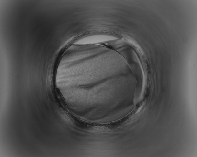 X0000086770399200705111739