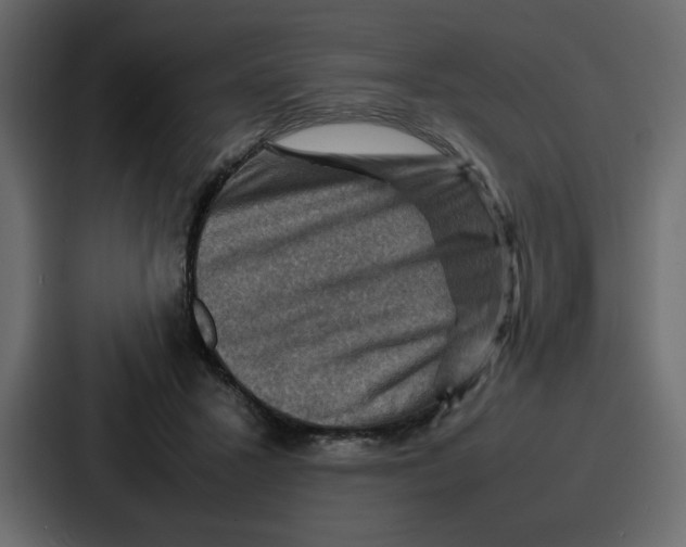 X0000086770407200705111739