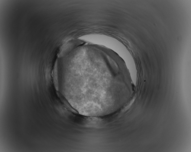 X0000086770429200705111739
