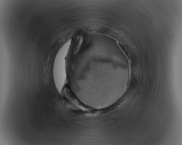 X0000086770818200705111733