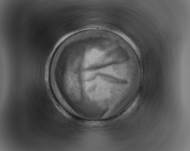 X0000086770862200705111734