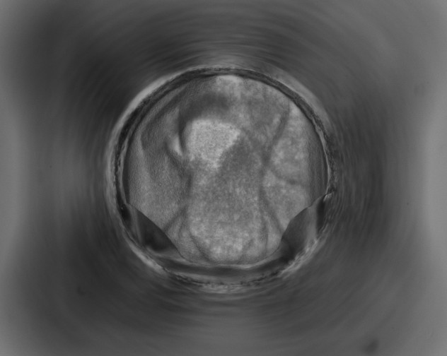 X0000086771120200705111730