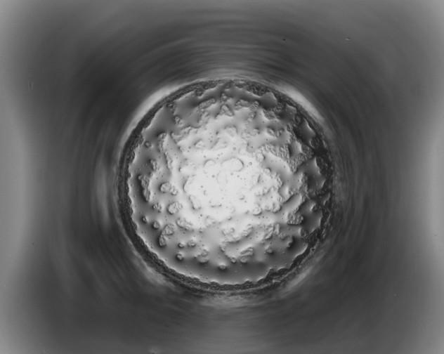 X0000086781094200704201819