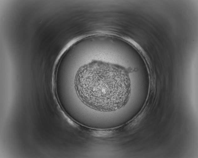 X0000086781294200704201817