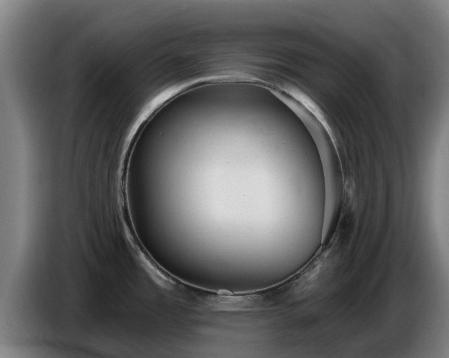 X0000086781485200704201814