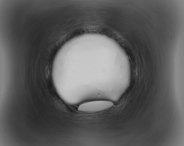 X0000086781204200705041521