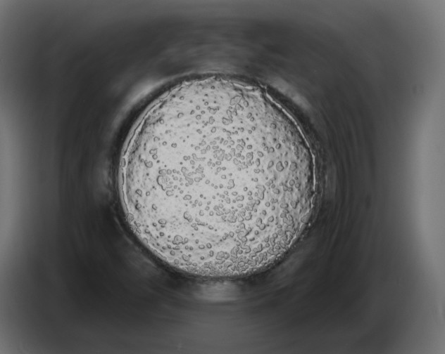 X0000086781454200705041518