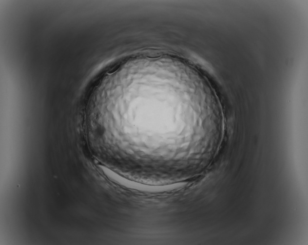 X0000086781496200705041517