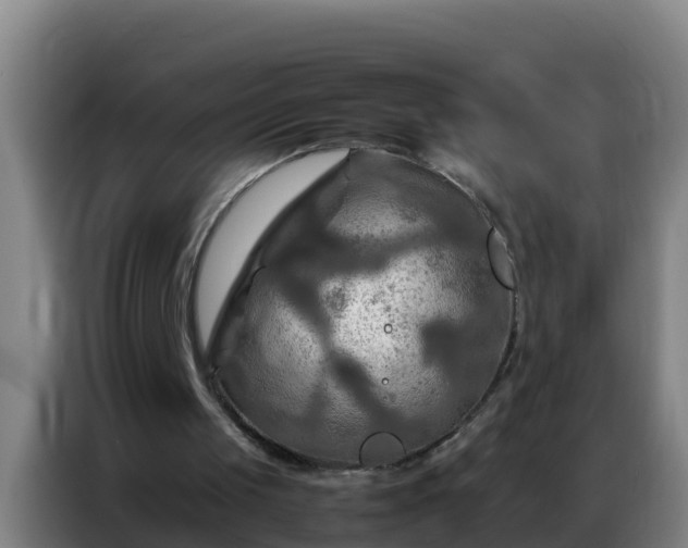 X0000086790049200704201851