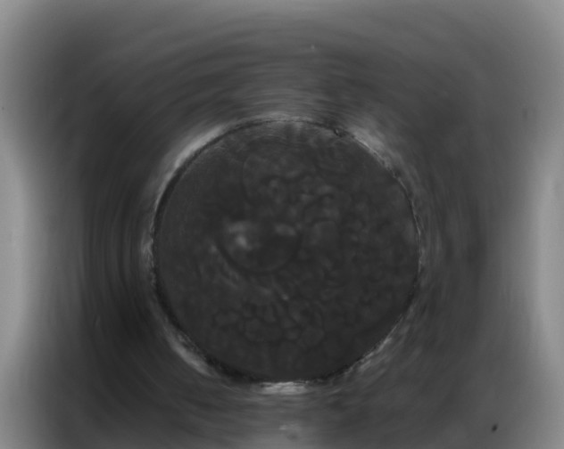 X0000086790050200704201851