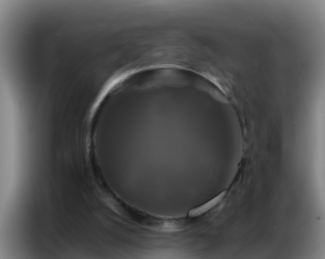 X0000086790056200704201852