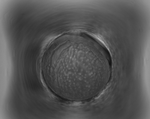 X0000086790097200704201851