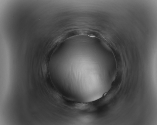 X0000086790139200704201851