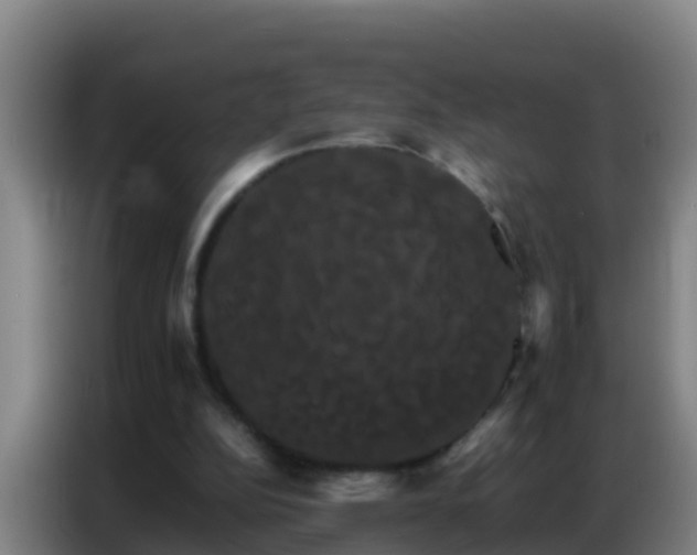 X0000086790152200704201850