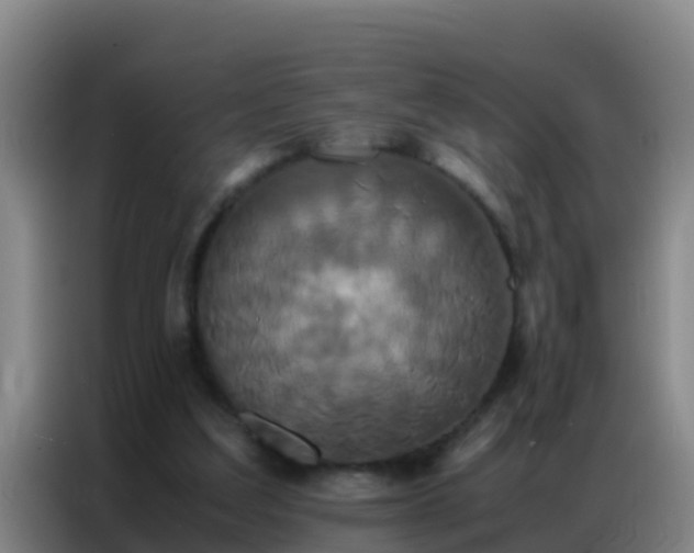 X0000086790203200704201850