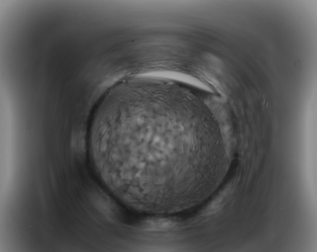 X0000086790299200704201849