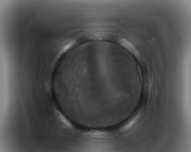 X0000086790585200704201845