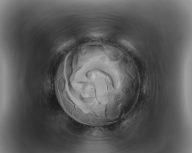 X0000086790966200704201840