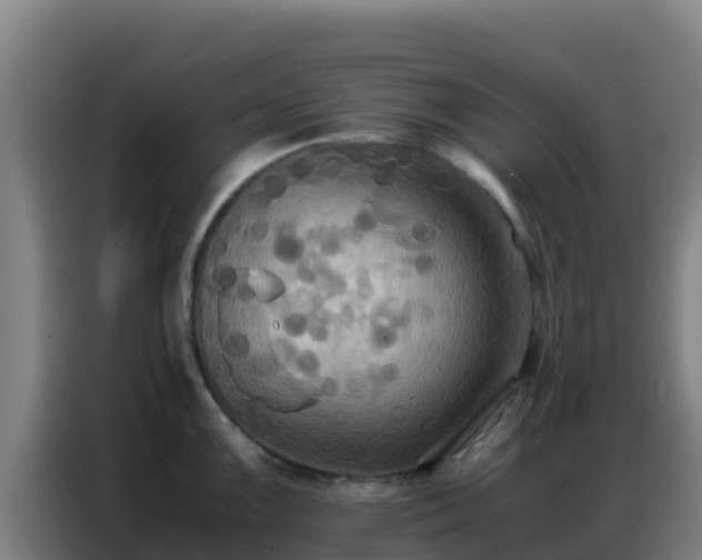 X0000086791099200704201839