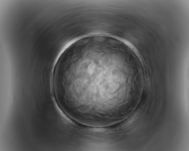 X0000086791295200704201836
