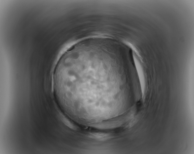 X0000086791371200704201835