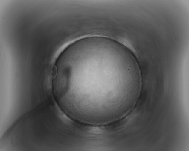 X0000086791504200704201833