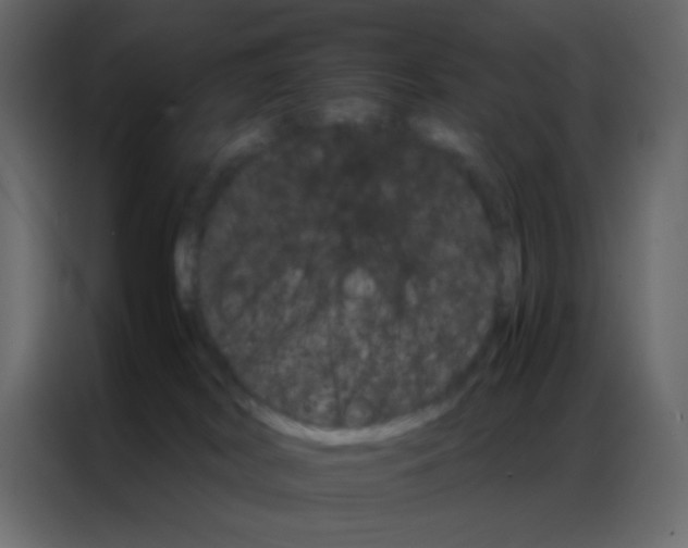 X0000086790038200705041557