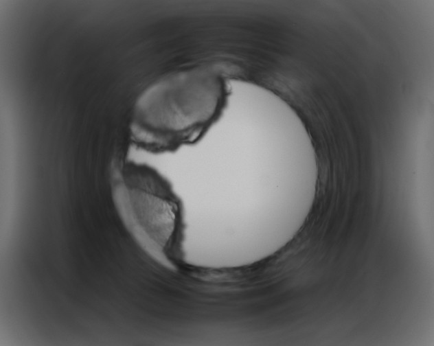 X0000086790177200705041555