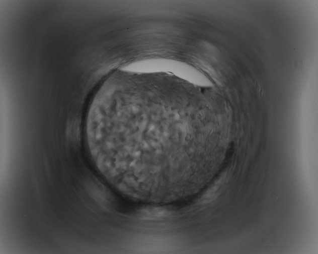 X0000086790299200705041554