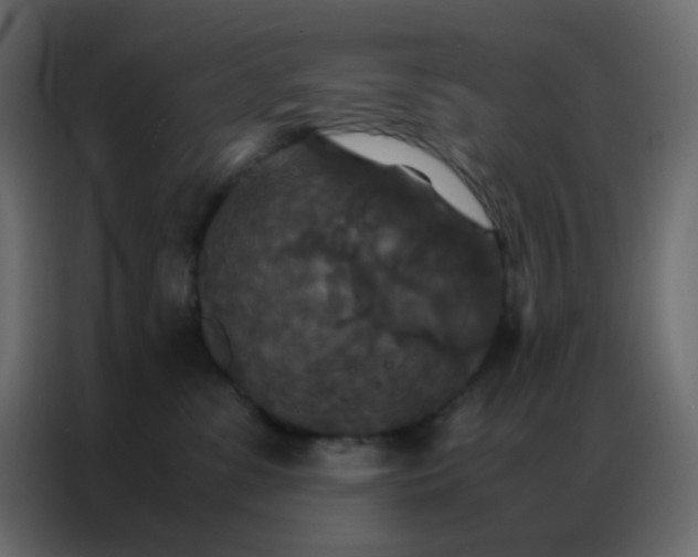 X0000086790331200705041553