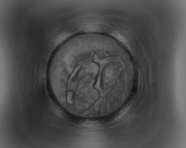 X0000086790487200705041551