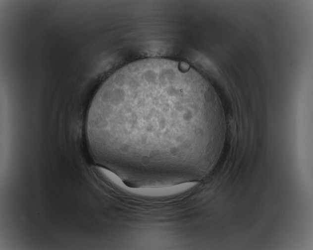 X0000086790499200705041551