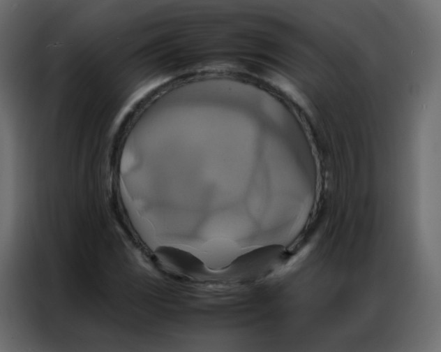 X0000086791117200705041542