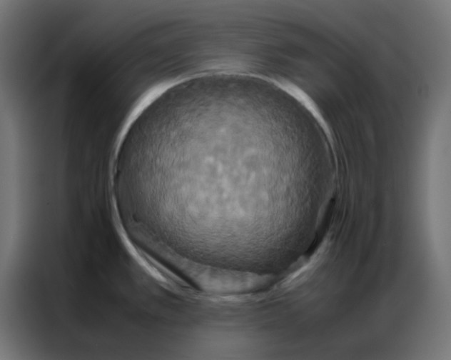 X0000086791389200705041539