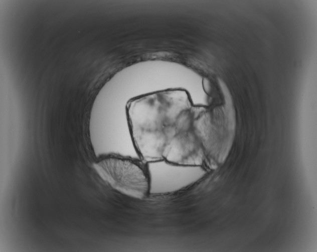 X0000086791393200705041538