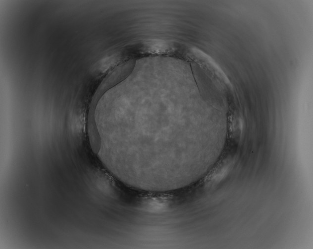 X0000086790368200705111820