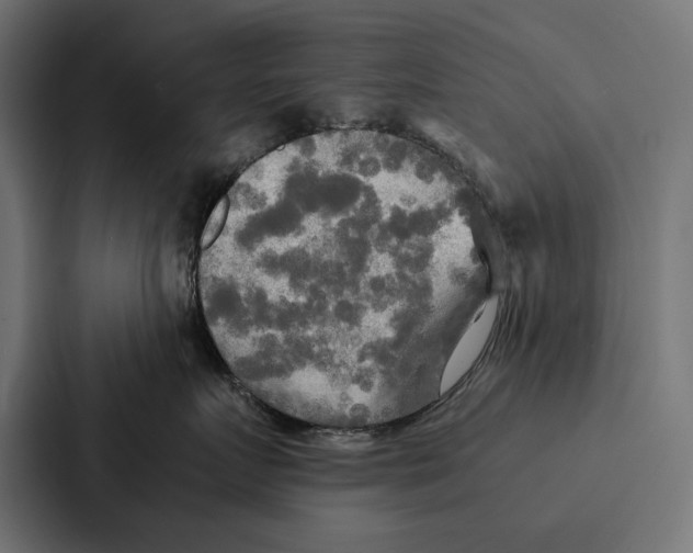 X0000086790719200705111815