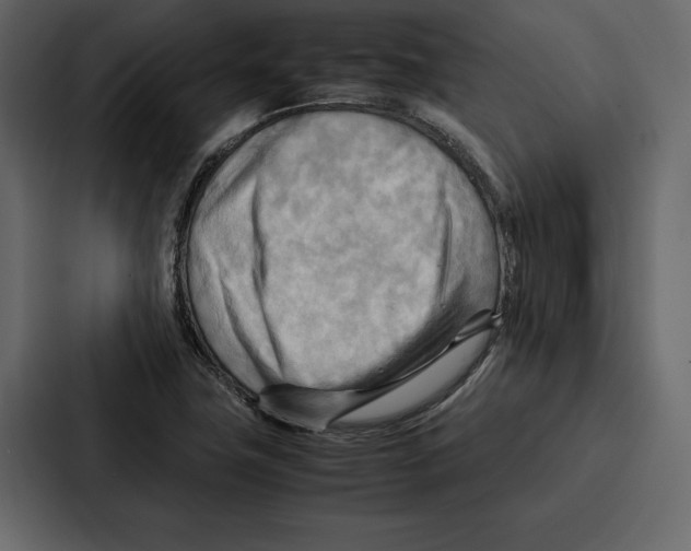 X0000086791411200705111806