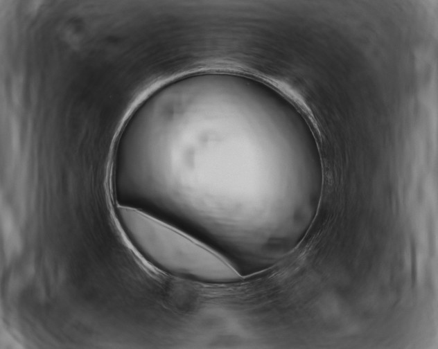X0000086801391200704130851
