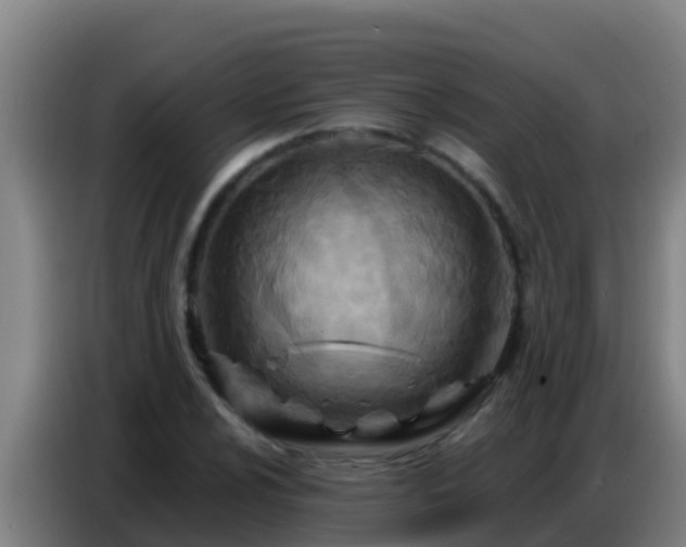 X0000086801024200704201859