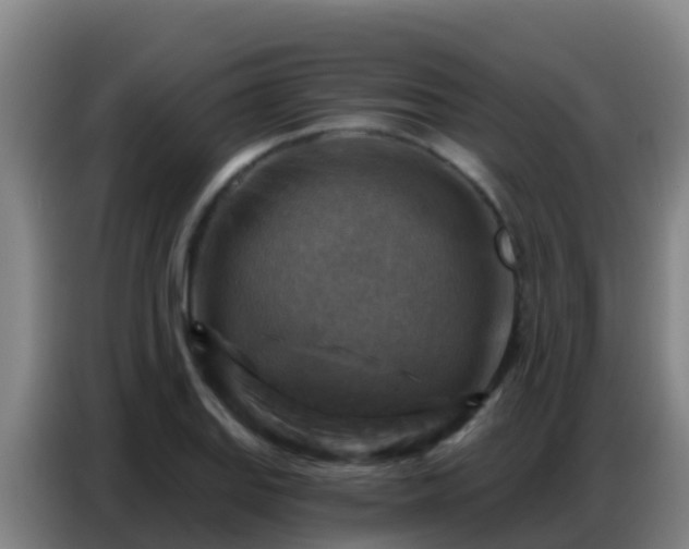 X0000086801127200704201858