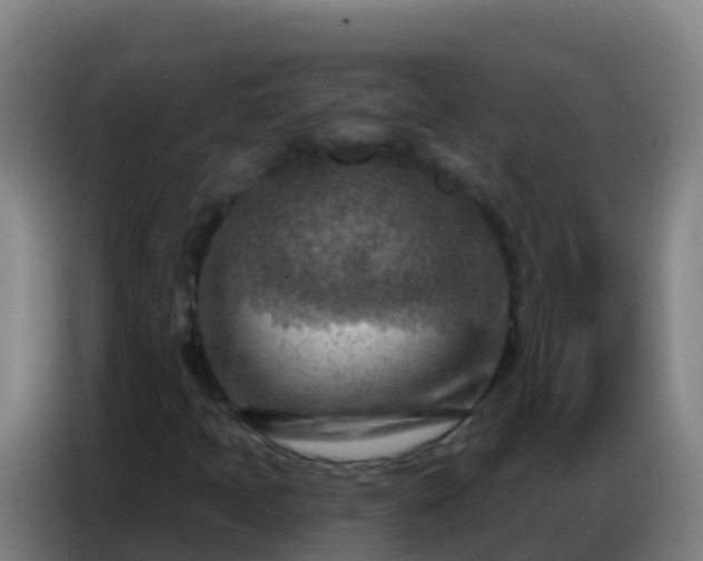 X0000086801397200704201854