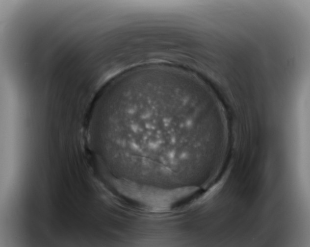 X0000086801497200704201853