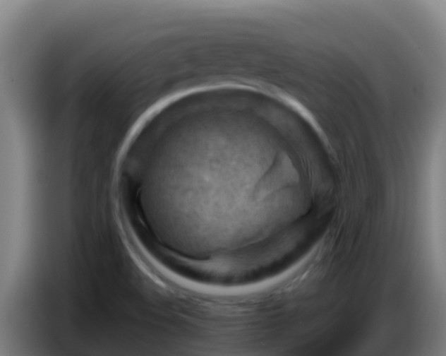 X0000086801508200704201853