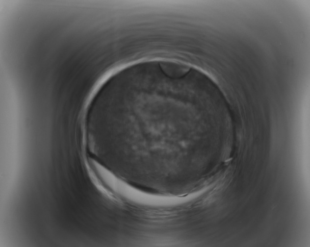 X0000086801515200704201853