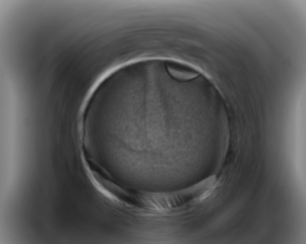 X0000086801519200704201853