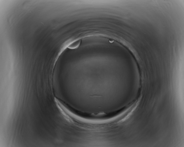 X0000086801529200704201853