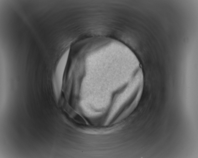 X0000086800017200705041617