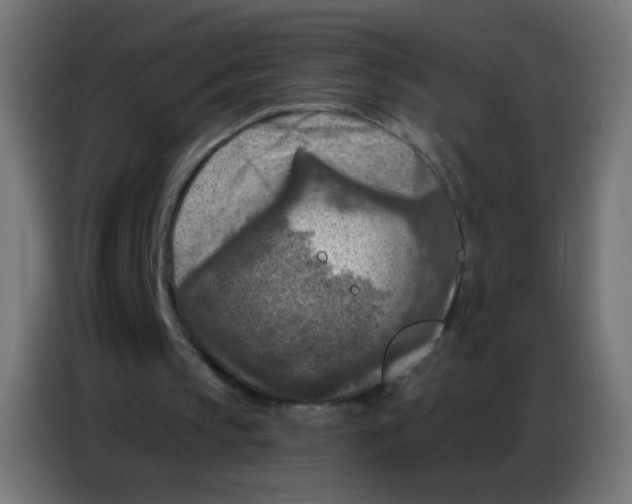 X0000086800145200705041615