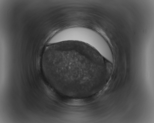 X0000086800154200705041615